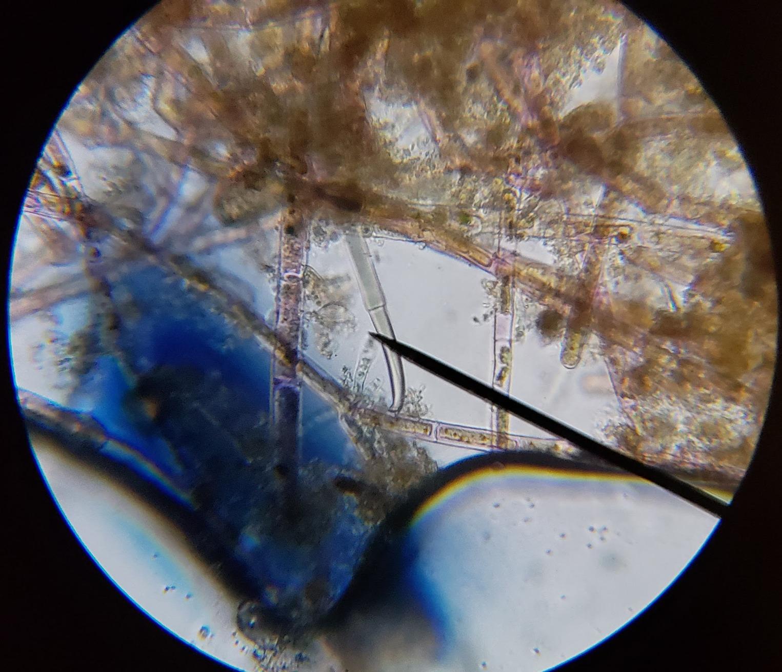 AmScope M150C1000X All-Metal Optical Glass Lenses Cordless LED | 40X-1000X Magnification Range Compound Biological Microscope All-Metal Construction Cordless Battery Powered customer photo 1