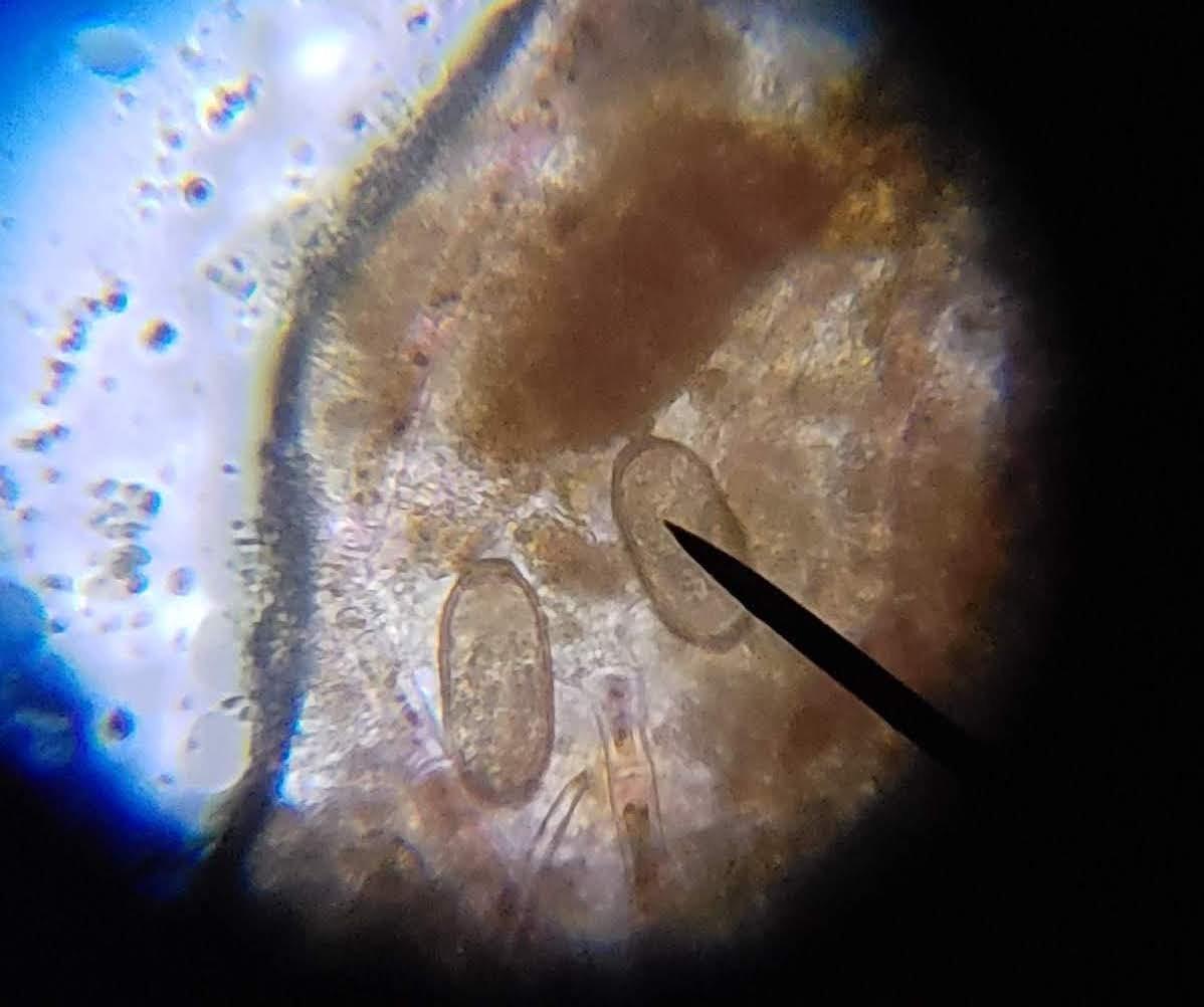 AmScope M150C1000X All-Metal Optical Glass Lenses Cordless LED | 40X-1000X Magnification Range Compound Biological Microscope All-Metal Construction Cordless Battery Powered customer photo 2