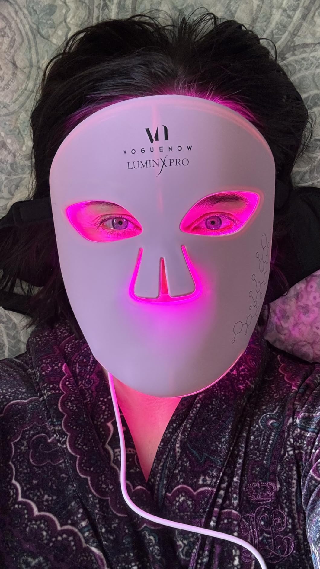 LuminX Pro LED Red Light Therapy Mask for Wrinkles & Acne | FDA-Cleared, 280 LEDs, Red, Blue, NIR and Deep Near Infrared Facial Skincare Device, with Chin and Lip Coverage customer photo 1