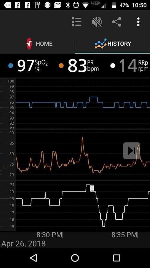 Masimo MightySat Fingertip Pulse Oximeter with Bluetooth, Monitor Blood Oxygen Saturation and Breath per Minute, OLED Screen, Touchpad, Long Battery Life customer photo 2