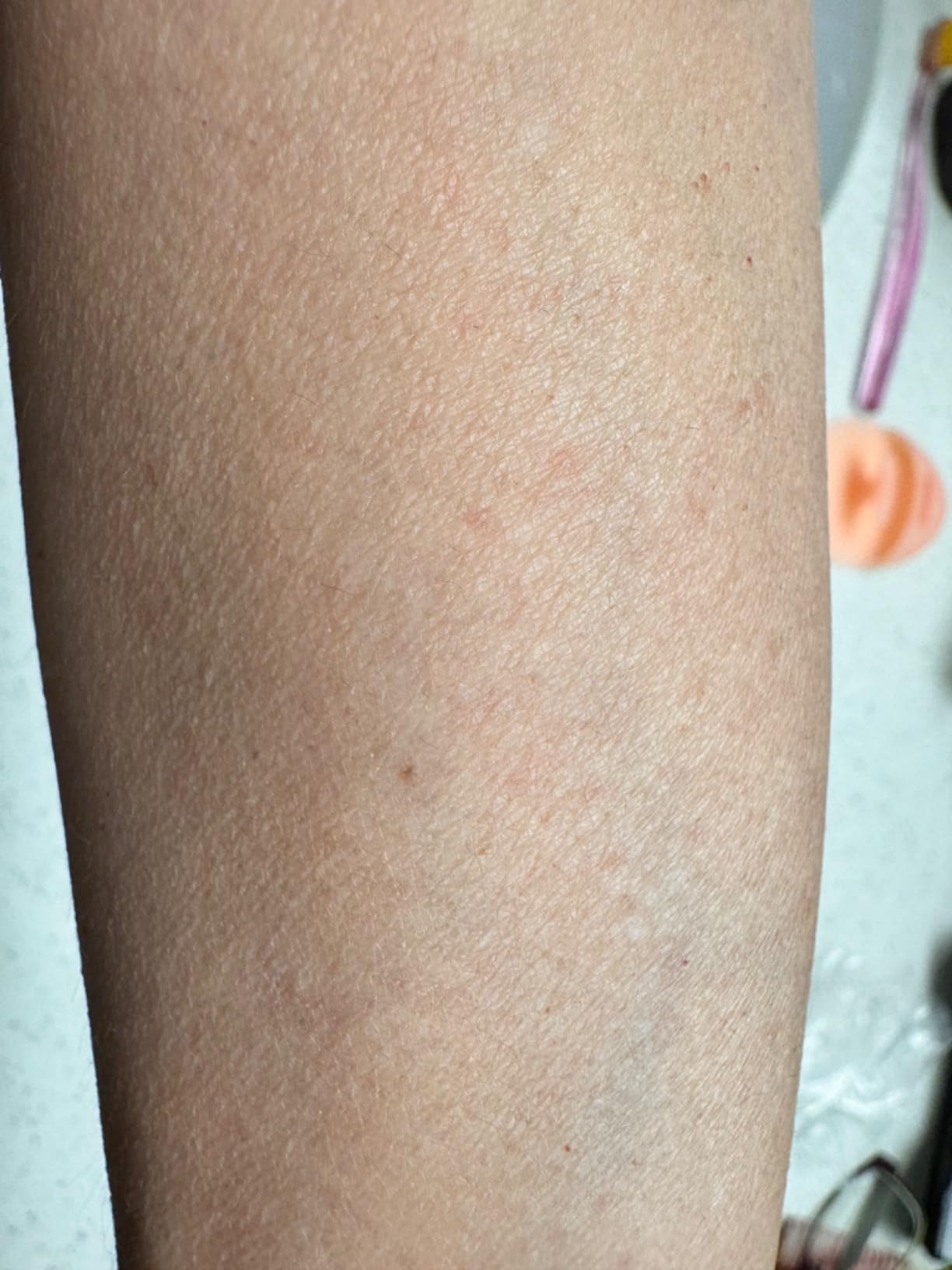 Braun Silk-épil 3 3-270, Epilator for Women for Long-Lasting Hair Removal, 20 Tweezer System, Smartlight Technology, Massage Rollers, Shaver and Trimmer Head Included customer photo 1