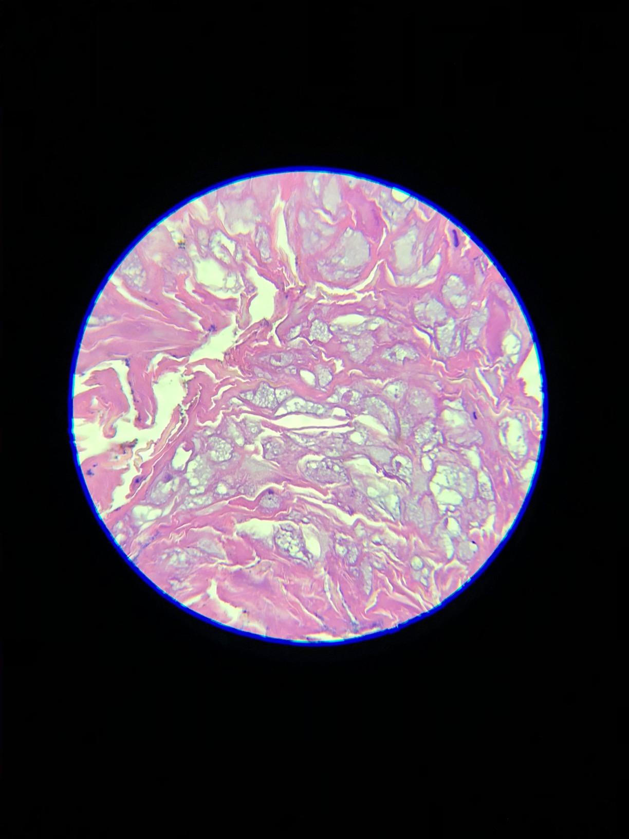 Swift SW380T 40X-2500X Magnification, Siedentopf Head, Research-Grade Trinocular Microscope Compound Lab with Wide-Field 10X/25X Eyepieces, Mechanical Stage, Ultra-Precise Focusing, Camera-Compatible customer photo 1