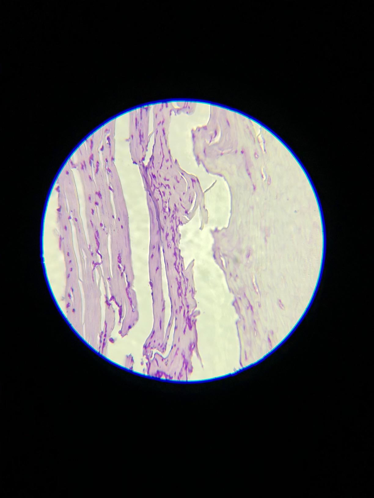 Swift SW380T 40X-2500X Magnification, Siedentopf Head, Research-Grade Trinocular Microscope Compound Lab with Wide-Field 10X/25X Eyepieces, Mechanical Stage, Ultra-Precise Focusing, Camera-Compatible customer photo 2