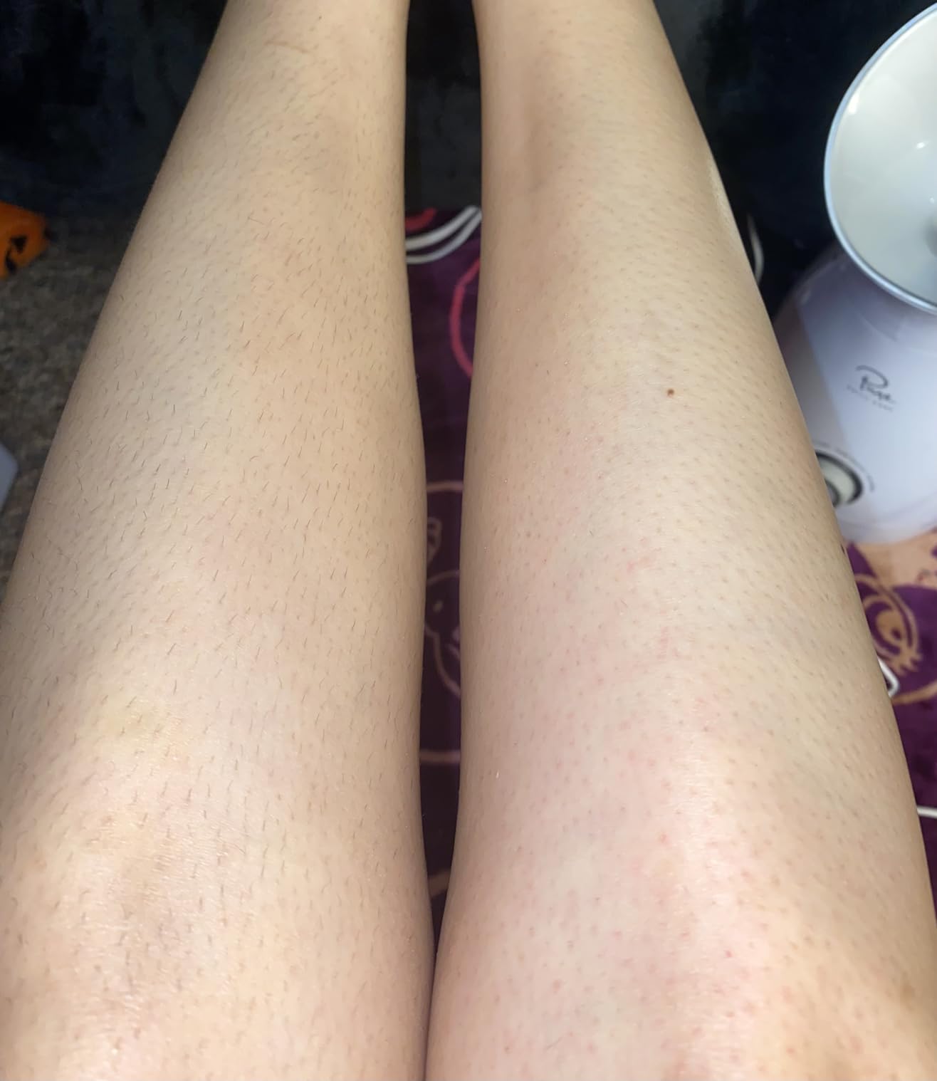 Philips Epilator Series 2000, Corded Epilator for Legs and Body, Hair Removal Device for Women, Model BRE227/00 customer photo 1